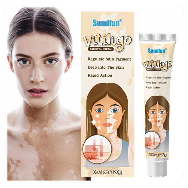 SUMIFUN VITILIGO CREMA ELIMINADORA 20g