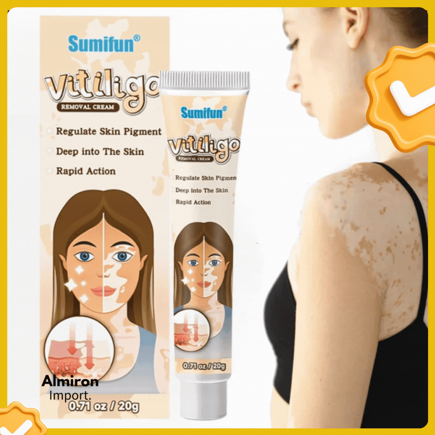 SUMIFUN VITILIGO CREMA ELIMINADORA 20g