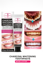 CREMA BLANQUEADORA DE DIENTES